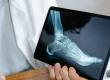 Doctor holding a tablet displaying a foot X-ray.