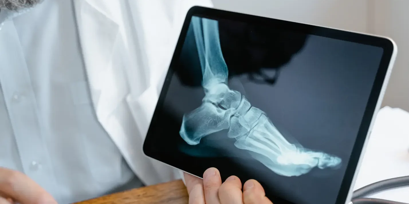 Orthopedic Doctor holding a tablet displaying a foot X-ray.