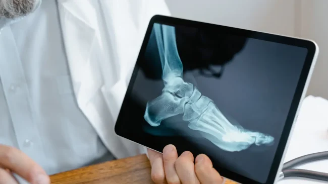 Orthopedic Doctor holding a tablet displaying a foot X-ray.