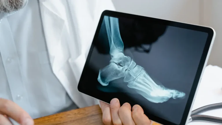 Doctor holding a tablet displaying a foot X-ray.